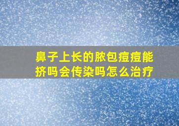 鼻子上长的脓包痘痘能挤吗会传染吗怎么治疗