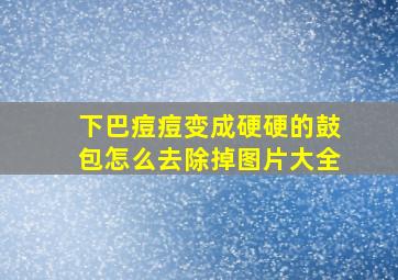 下巴痘痘变成硬硬的鼓包怎么去除掉图片大全