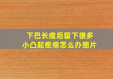 下巴长痘后留下很多小凸起疙瘩怎么办图片