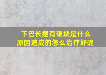 下巴长痘有硬块是什么原因造成的怎么治疗好呢