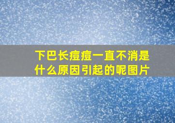 下巴长痘痘一直不消是什么原因引起的呢图片