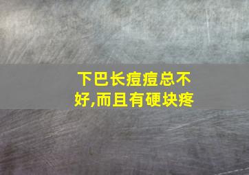 下巴长痘痘总不好,而且有硬块疼