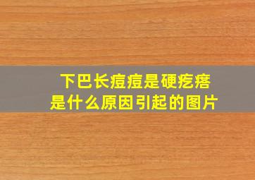 下巴长痘痘是硬疙瘩是什么原因引起的图片