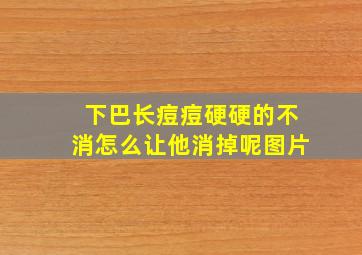 下巴长痘痘硬硬的不消怎么让他消掉呢图片