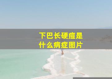 下巴长硬痘是什么病症图片