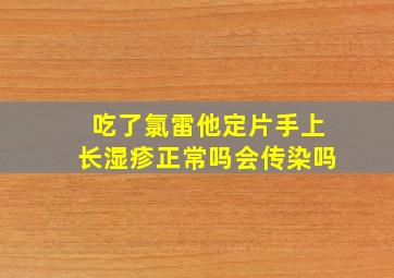 吃了氯雷他定片手上长湿疹正常吗会传染吗