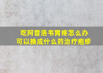 吃阿昔洛韦胃疼怎么办可以换成什么药治疗疱疹