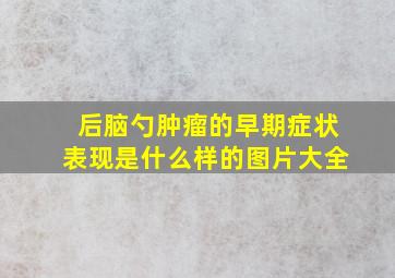 后脑勺肿瘤的早期症状表现是什么样的图片大全