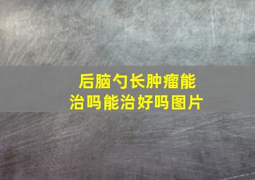 后脑勺长肿瘤能治吗能治好吗图片