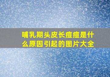 哺乳期头皮长痘痘是什么原因引起的图片大全