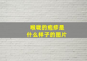 喉咙的疱疹是什么样子的图片