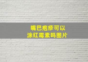 嘴巴疱疹可以涂红霉素吗图片