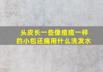 头皮长一些像痘痘一样的小包还痛用什么洗发水