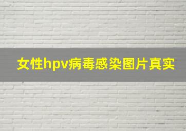 女性hpv病毒感染图片真实