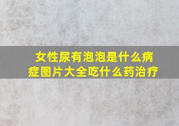 女性尿有泡泡是什么病症图片大全吃什么药治疗