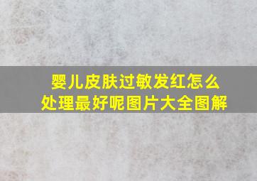 婴儿皮肤过敏发红怎么处理最好呢图片大全图解