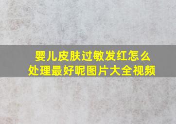 婴儿皮肤过敏发红怎么处理最好呢图片大全视频