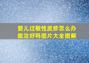 婴儿过敏性皮疹怎么办能治好吗图片大全图解