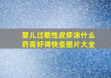 婴儿过敏性皮疹涂什么药膏好得快些图片大全