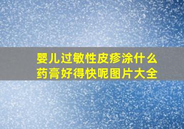 婴儿过敏性皮疹涂什么药膏好得快呢图片大全