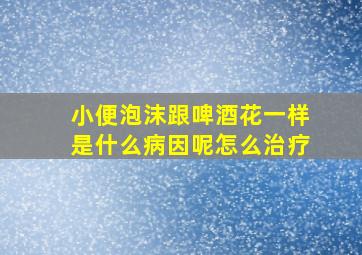 小便泡沫跟啤酒花一样是什么病因呢怎么治疗