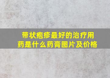 带状疱疹最好的治疗用药是什么药膏图片及价格