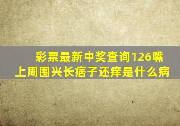 彩票最新中奖查询126嘴上周围兴长痞子还痒是什么病