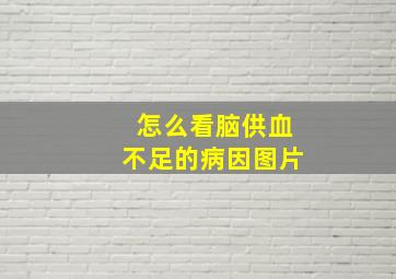 怎么看脑供血不足的病因图片