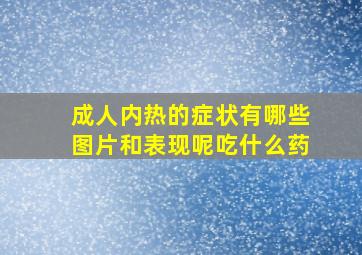 成人内热的症状有哪些图片和表现呢吃什么药