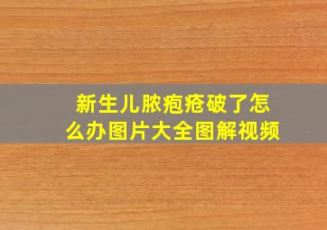 新生儿脓疱疮破了怎么办图片大全图解视频