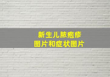 新生儿脓疱疹图片和症状图片