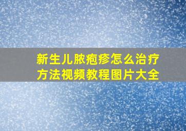 新生儿脓疱疹怎么治疗方法视频教程图片大全