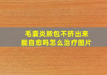 毛囊炎脓包不挤出来能自愈吗怎么治疗图片