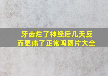 牙齿烂了神经后几天反而更痛了正常吗图片大全