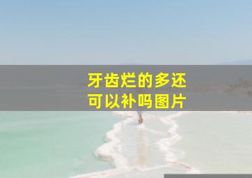 牙齿烂的多还可以补吗图片