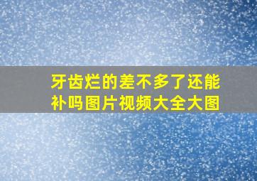 牙齿烂的差不多了还能补吗图片视频大全大图