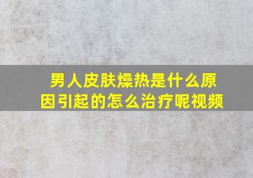 男人皮肤燥热是什么原因引起的怎么治疗呢视频