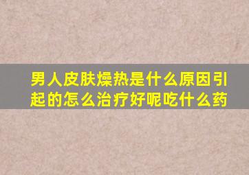 男人皮肤燥热是什么原因引起的怎么治疗好呢吃什么药