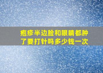 疱疹半边脸和眼睛都肿了要打针吗多少钱一次