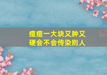 痘痘一大块又肿又硬会不会传染别人