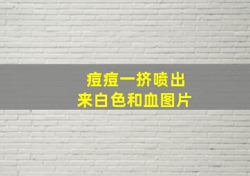 痘痘一挤喷出来白色和血图片