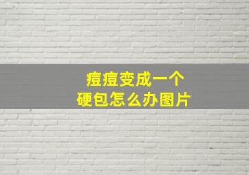 痘痘变成一个硬包怎么办图片