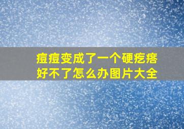 痘痘变成了一个硬疙瘩好不了怎么办图片大全