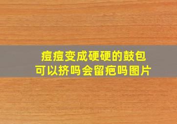 痘痘变成硬硬的鼓包可以挤吗会留疤吗图片