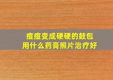 痘痘变成硬硬的鼓包用什么药膏照片治疗好