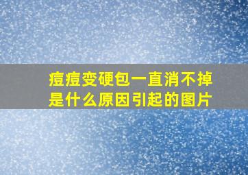 痘痘变硬包一直消不掉是什么原因引起的图片