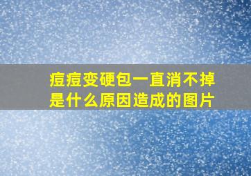 痘痘变硬包一直消不掉是什么原因造成的图片