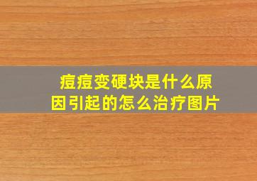 痘痘变硬块是什么原因引起的怎么治疗图片