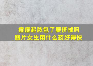 痘痘起脓包了要挤掉吗图片女生用什么药好得快