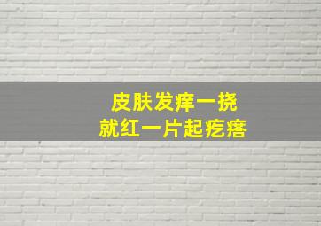 皮肤发痒一挠就红一片起疙瘩